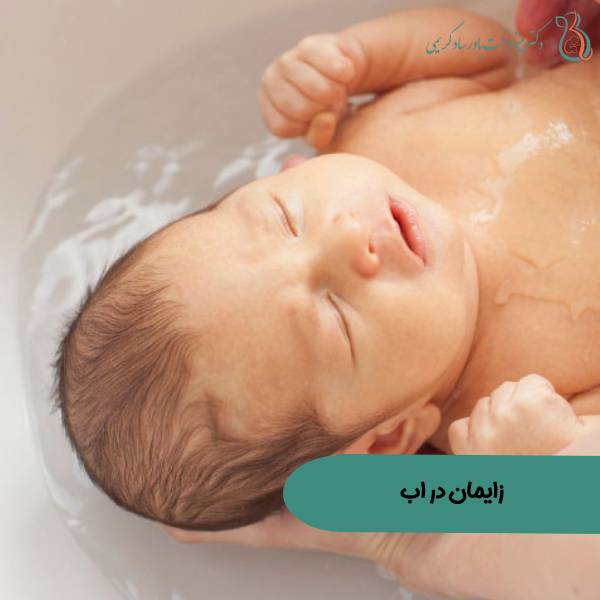 زایمان در آب