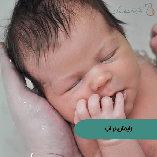 زایمان در آب