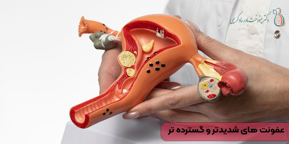 عفونت ‌های شدیدتر و گسترده ‌تر