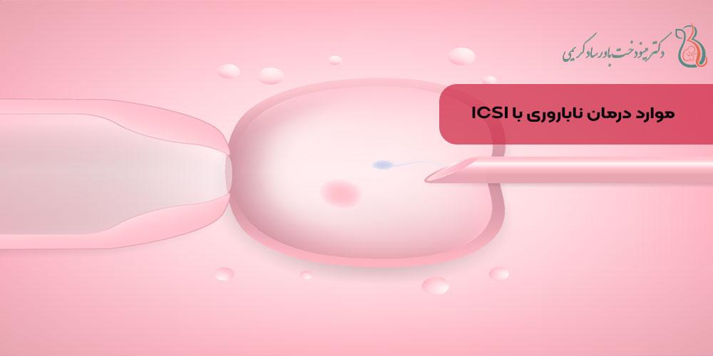 موارد درمان ناباروری با ICSI