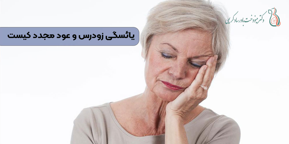 یائسگی زودرس و عود مجدد کیست