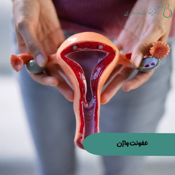 عکس عفونت دستگاه تناسلی