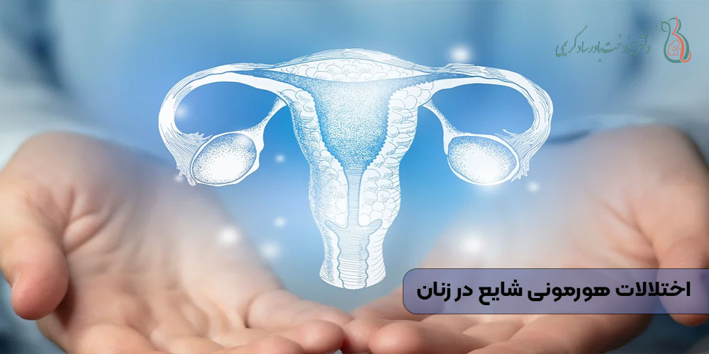 اختلالات هورمونی شایع در زنان
