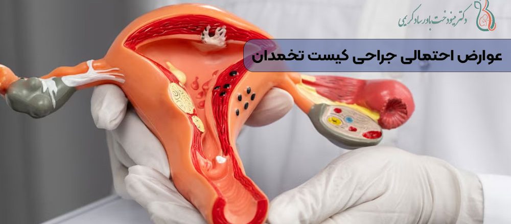 عوارض احتمالی جراحی کیست تخمدان