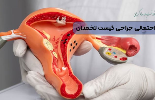 عوارض احتمالی جراحی کیست تخمدان