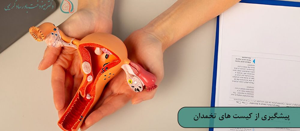 چگونگی پیشگیری از کیست های تخمدان و تخمدان پلی‌کیستیک