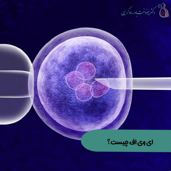 ivf آی وی اف
