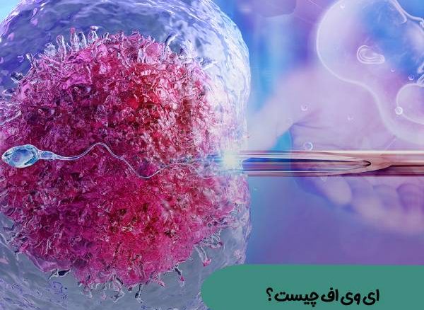 عکس آی وی اف