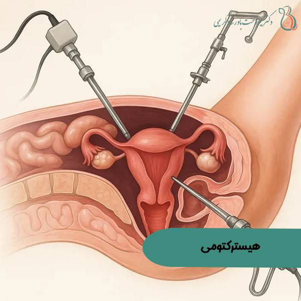 عکس عمل خارج کردن رحم