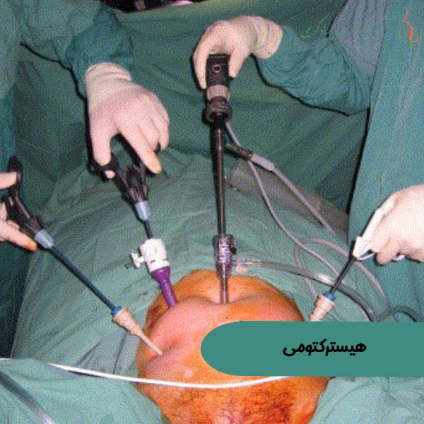 عکس واقعی هیسترکتومی یا خارج کردن رحم