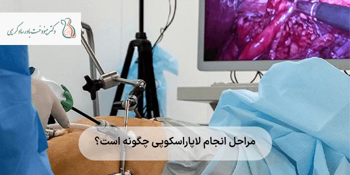 مراحل انجام لاپاراسکوپی چگونه است؟